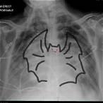 bet wing ner